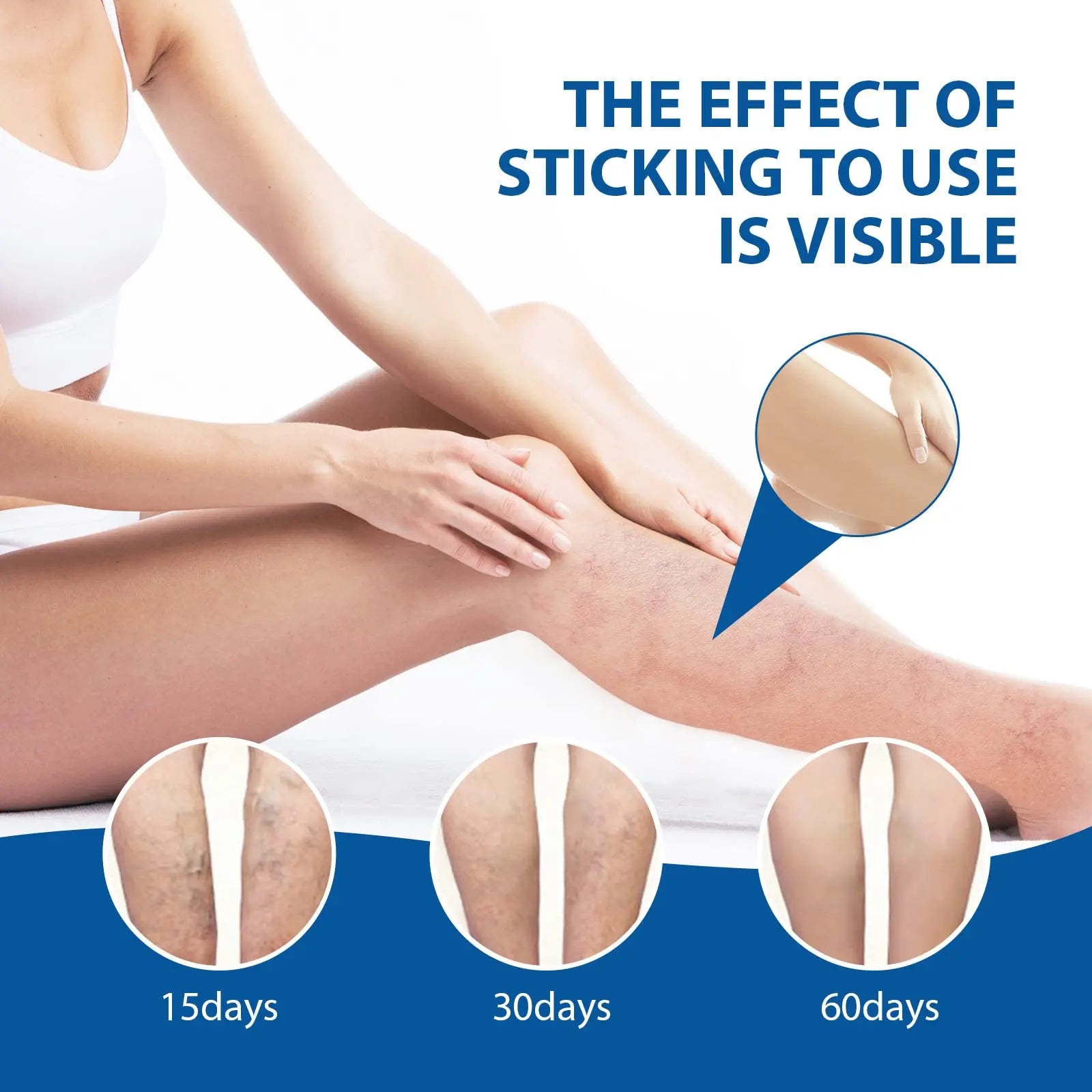 Varicose Veins Pen Repair