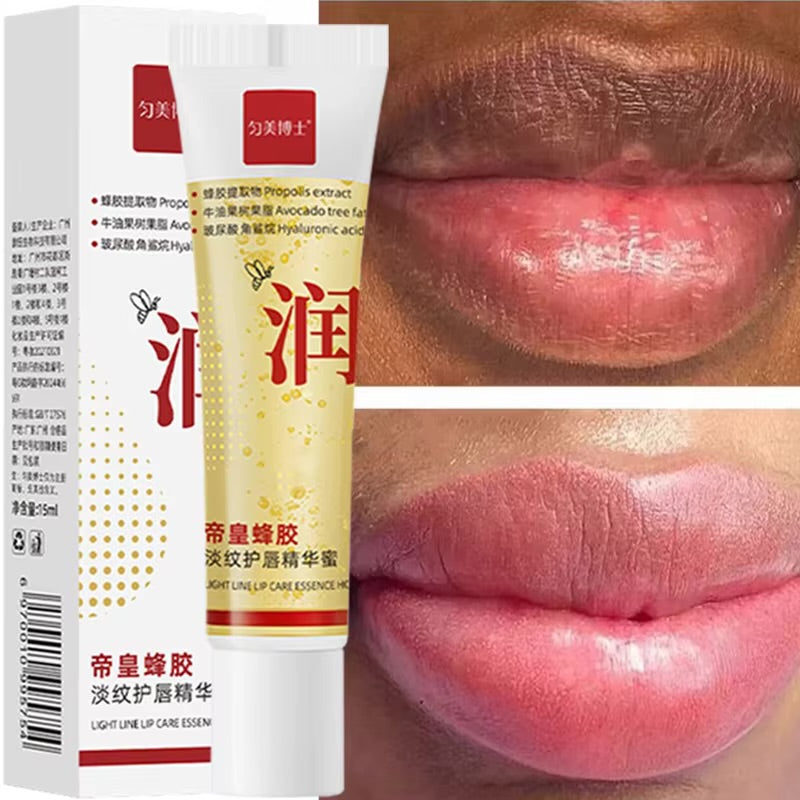 Dark Lip Health Balm