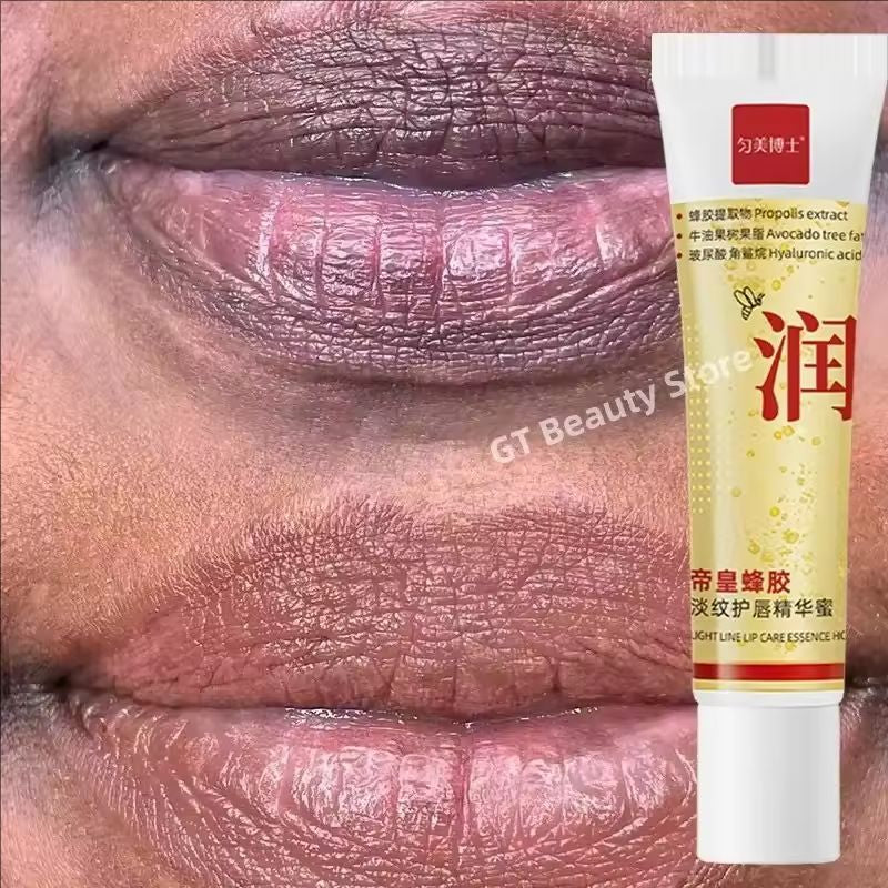 Dark Lip Health Balm